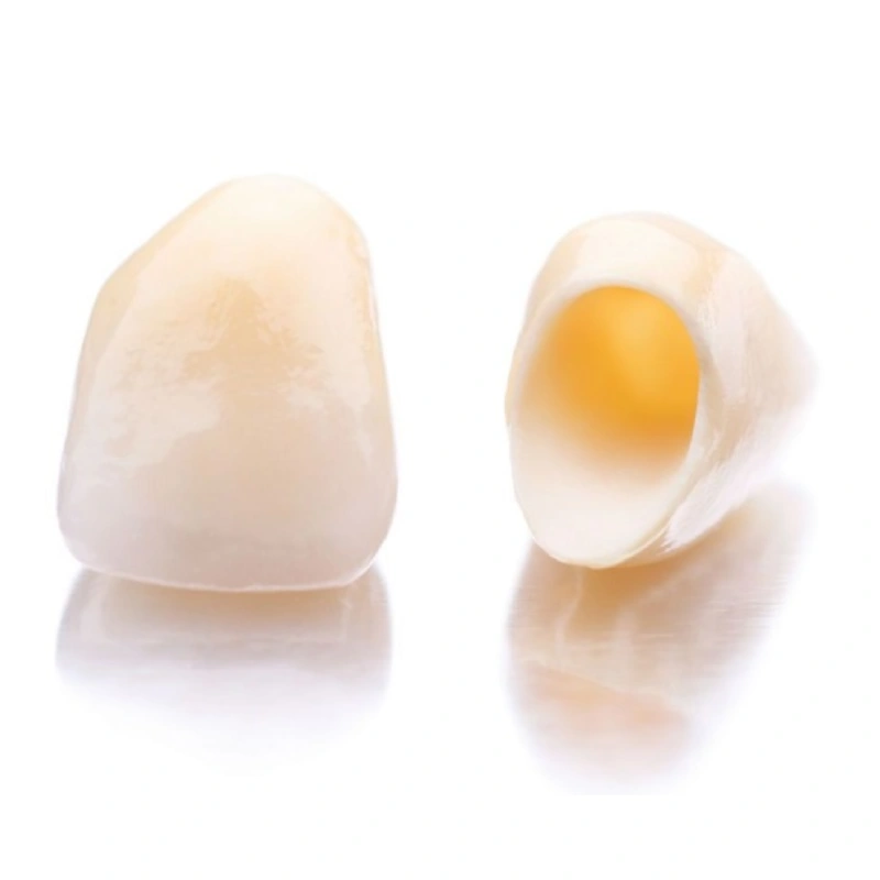 Mão răng sứ đóng vai trò thay thế hoàn toàn cho phần thân răng đã mất